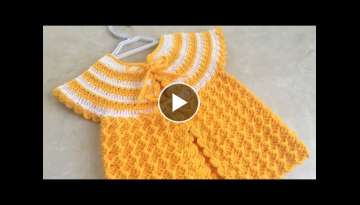 Round Robe Crochet Yellow Sugar Baby Vest/Baby Girl Vest with Model/1 for 1 year old Round Robe Crochet Yellow Sugar Baby Vest/Baby Girl Vest with Model/1 for 1 year old